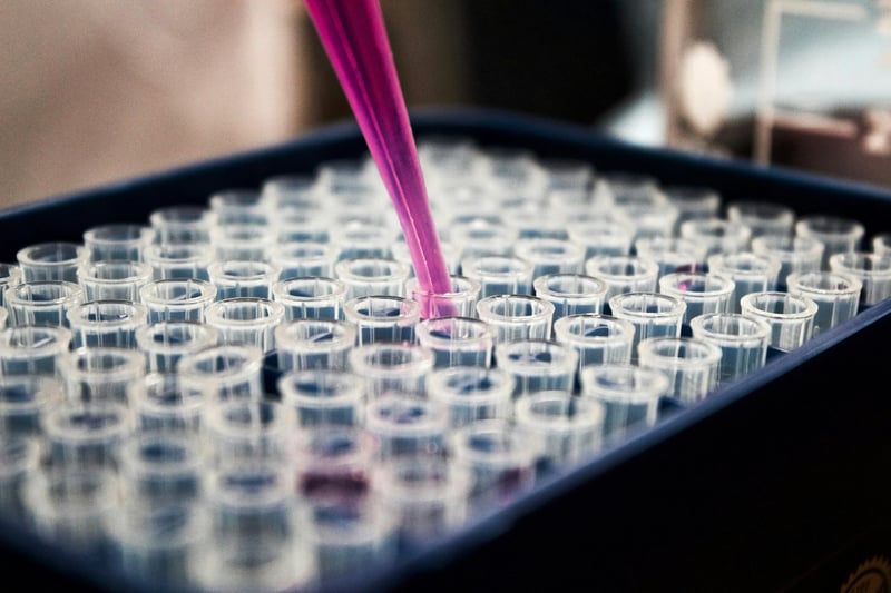 Laboratory test tubes representing EtG testing process