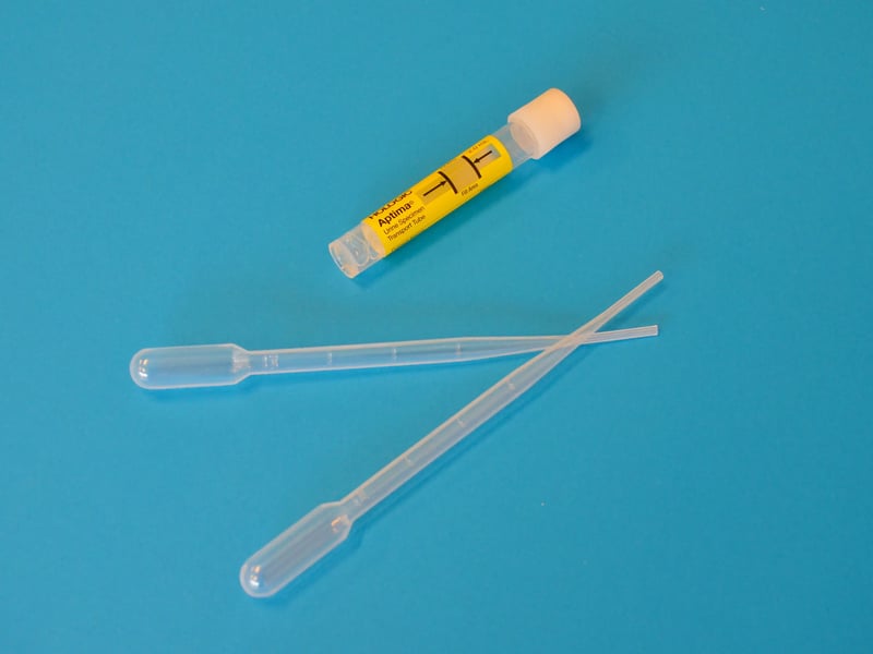 Urine sample tubes in a laboratory setting